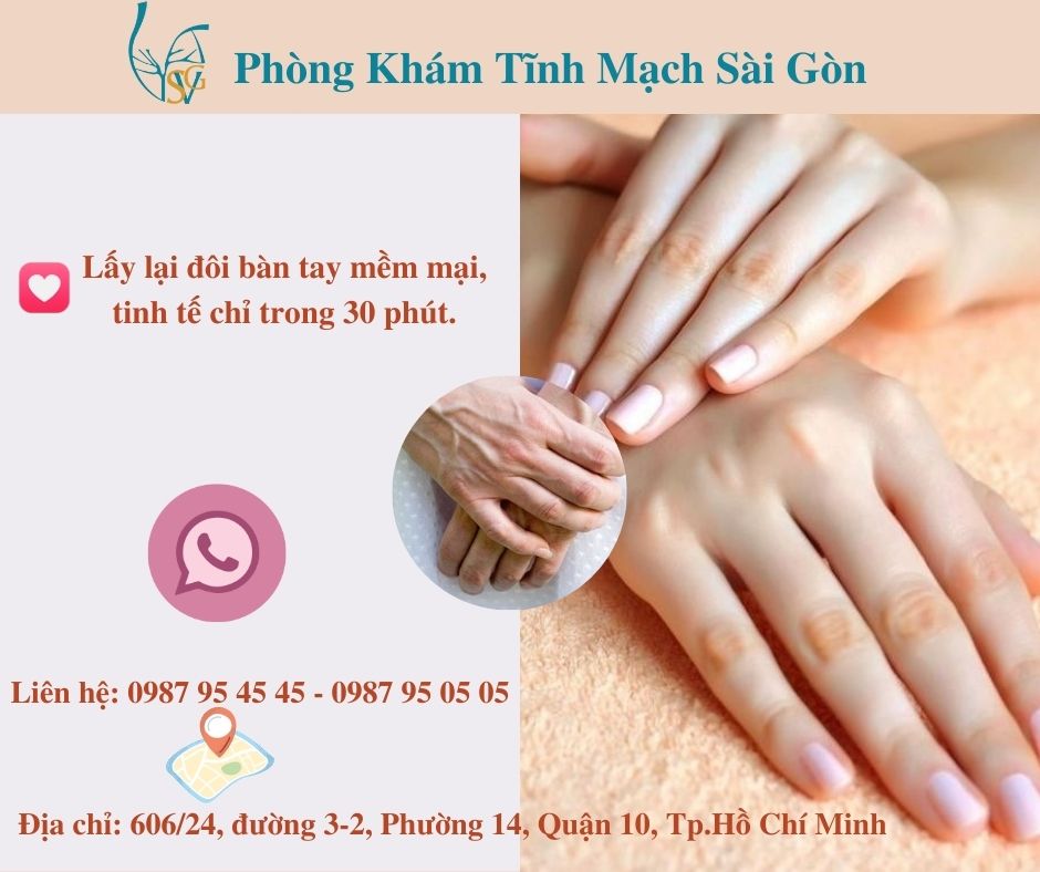 TS BS TRẦN THANH VỸ Vì sao các tĩnh mạch tay lại bị nổi phồng lên TS