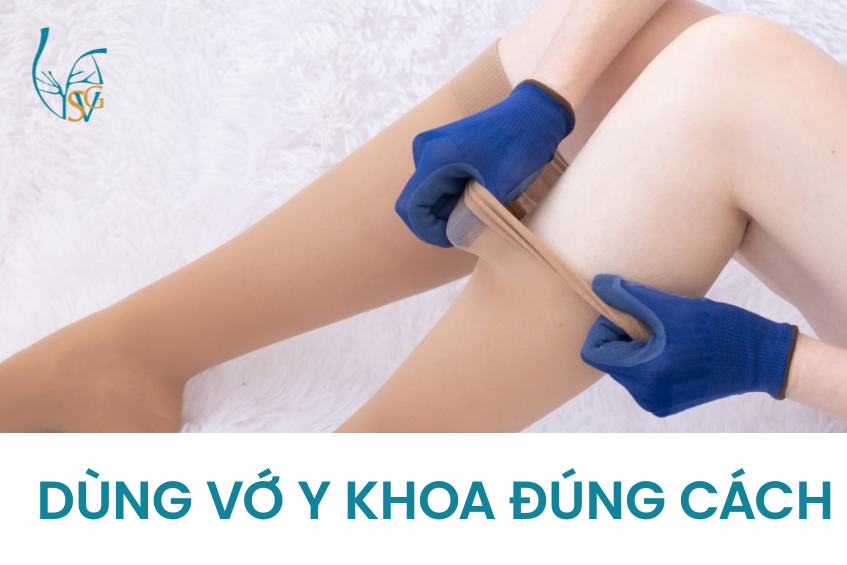di-vo-tinh-mach-gian-tinh-mach