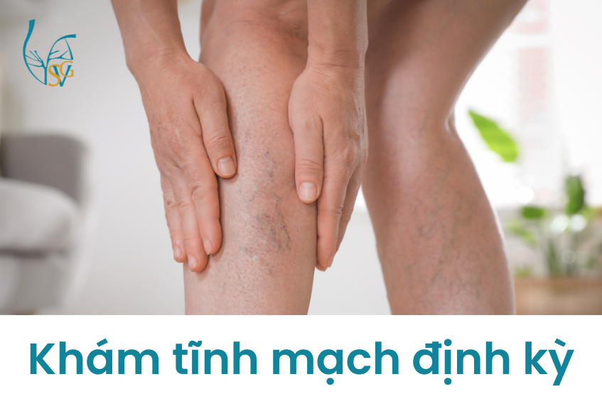 kham-tinh-mach-dinh-ky-gian-tinh-mach