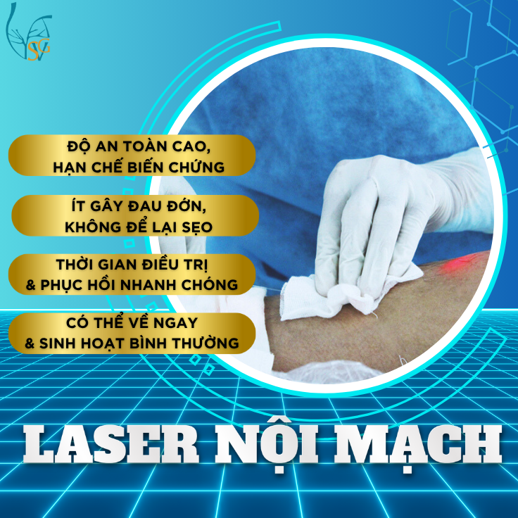 chua-gian-tinh-mach-laser-noi-mach