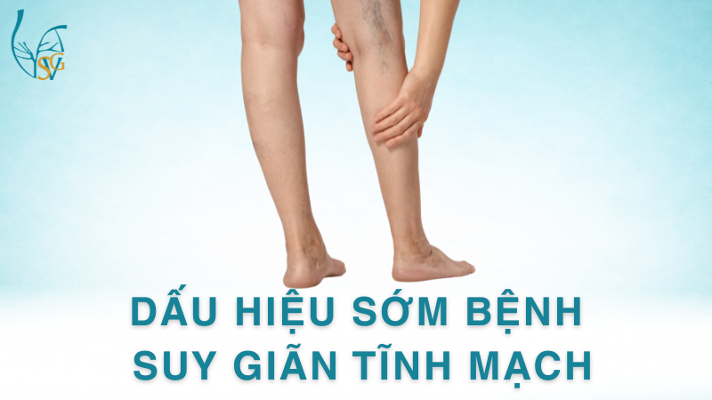 dau-hieu-som-benh-suy-gian-tinh-mach-pgs-ts-bs-tran-thanh-vy (1)