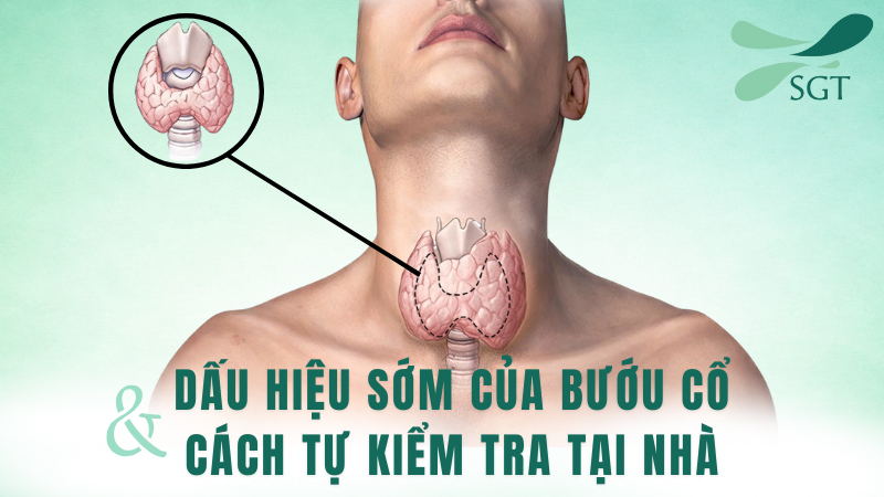 dau-hieu-som-cua-buou-co-cach-tu-kiem-tra-tai-nha